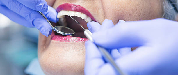 Best Emergency Treatment for Dental Infections or Abscesses in Nelsonville, OH